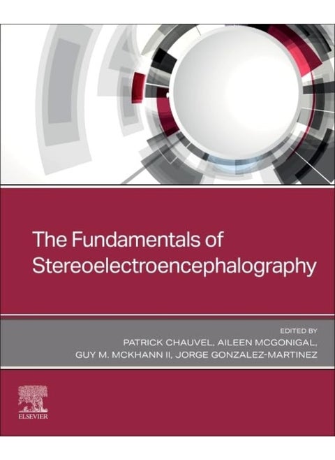 The Fundamentals of Stereoelectroencephalography