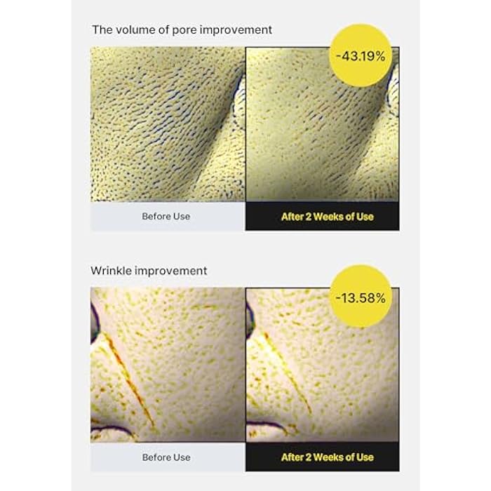 celimax The Vita A Retinol Shot Tightening Serum | with Pure Vitamin A Retinol, Peptide, Pore Minimizer, Wrinkles & Fine Lines, Firmer Skin, Anti-Aging, Skin Smoothing 30ml - Image 4