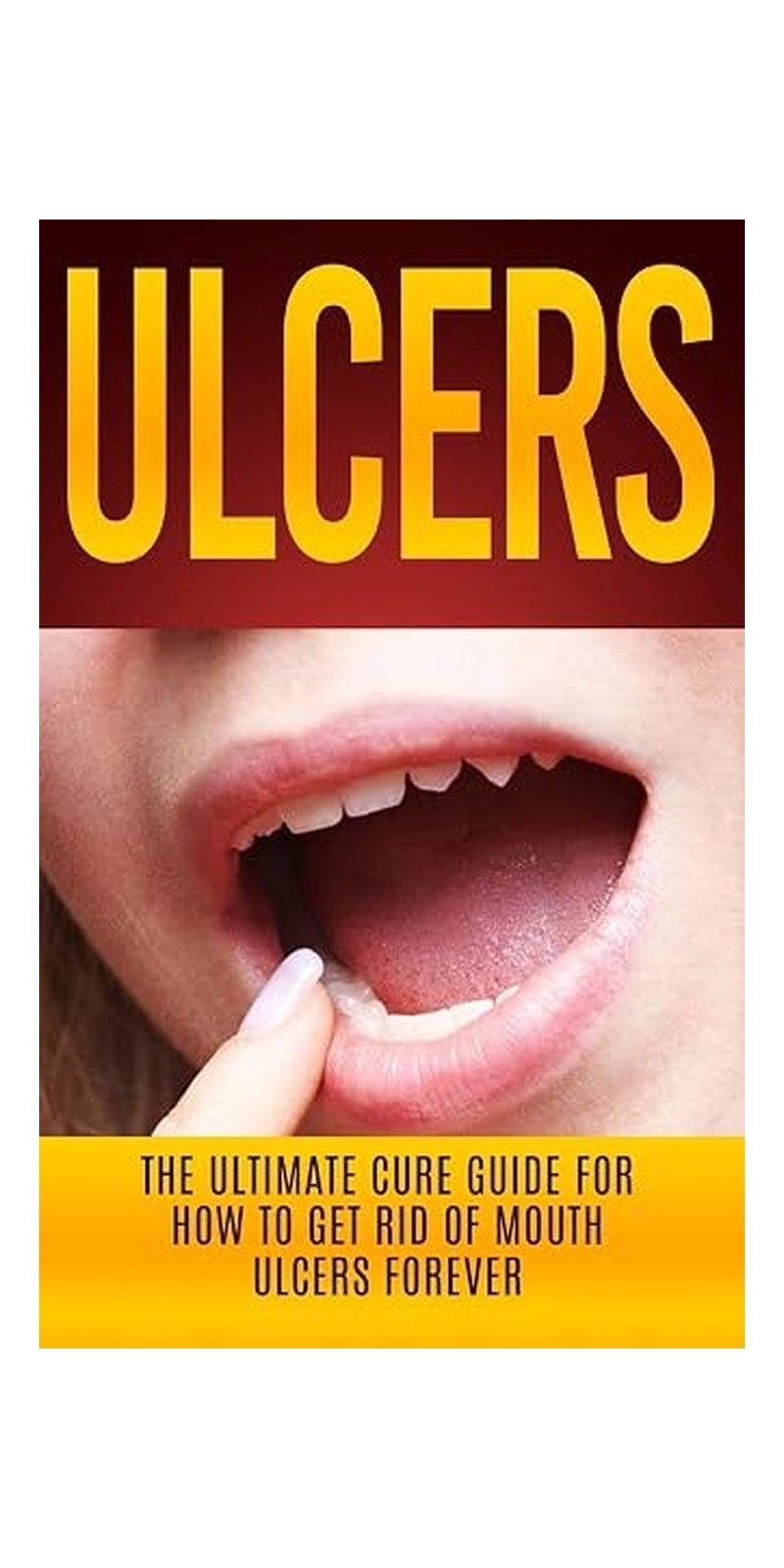 Ulcers: The Ultimate Cure Guide for How to Get Rid of Mouth Ulcers Instantly
