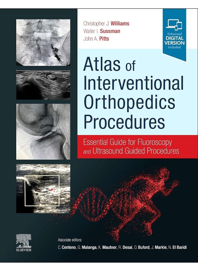 Atlas of Interventional Orthopedics Procedures: Essential Guide for Fluoroscopy and Ultrasound Gui 