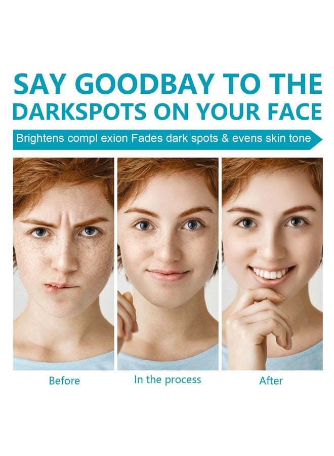 Rosarden Dark Spot Remover for Face and Body, Dark Spot Corrector Cream, Dark Spot Corrector Cream for Age Spot, Blemish Spot, Melasma, Freckle, Sun Spots Remover & Blemish Reducer for Women Men - Image 4