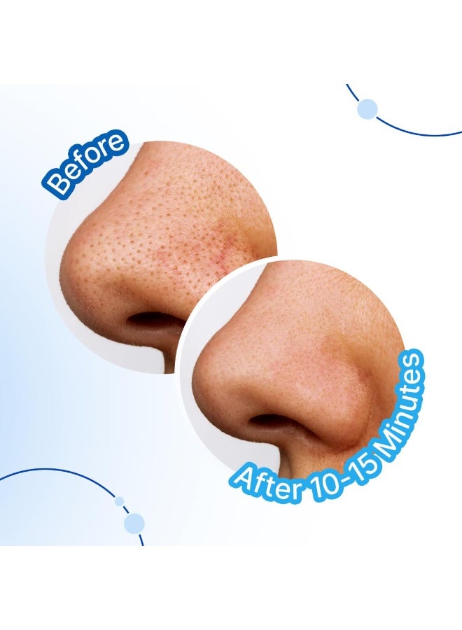 So True Sotrue Charcoal Nose Pore Deep Cleansing Strips | For Blackheads and Whiteheads Removal | Aloe vera Extract, Activated Charcoal | set of 4 Nose Strips - Image 3