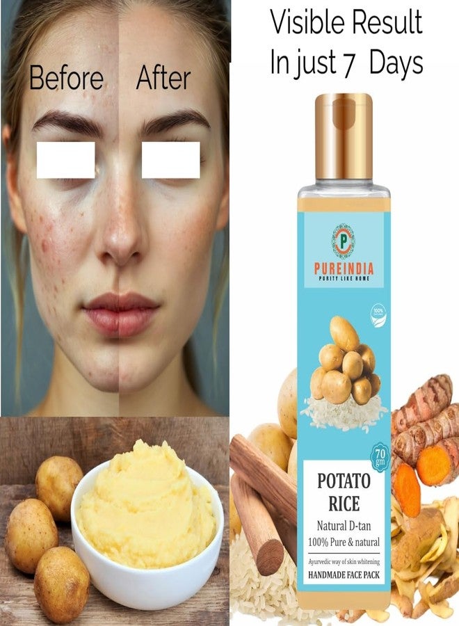 Pureindia Handmade Potato Rice Face Pack For Skin Whitening Removes Dark Spot | 50gm | All Skin Type | 100% Natural FacePack For Women & Men - Image 3