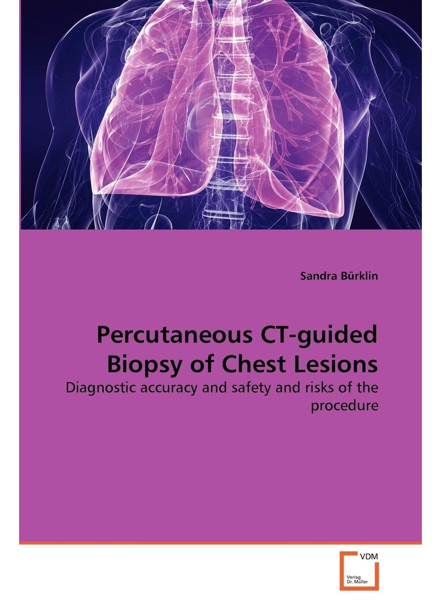 Percutaneous CT-guided Biopsy of Chest Lesions  - Image 1