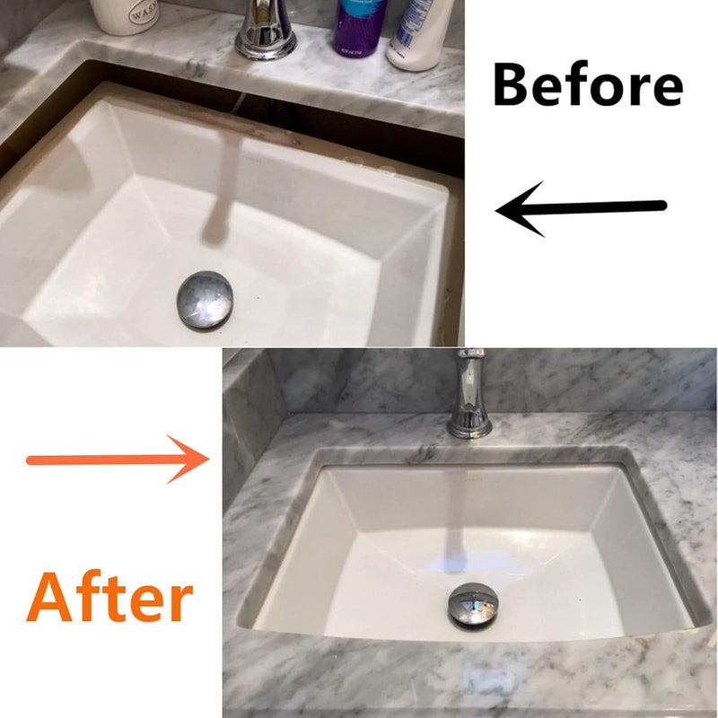 MY RUSTIC Undermount Sink Repair Kit, Brackets for Fallen Sink Support, Alloy Steel, Silver Gray, Undermount, 5 Count - Image 4