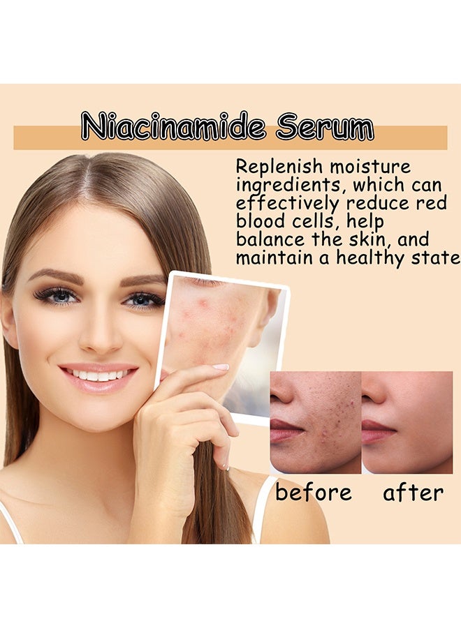 OUHOE Niacinamide Serum，10% Niacinamide + 8% NAG Serum – Dark Spot Corrector, Hydration Booster & Oil Control, Enhanced with Glycerin for Radiant Skin, For All Skin Types, Korean Skin Care  30ml - Image 5