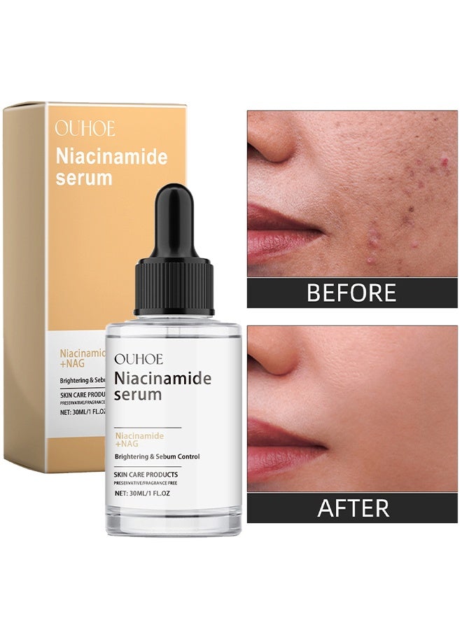 OUHOE Niacinamide Serum，10% Niacinamide + 8% NAG Serum – Dark Spot Corrector, Hydration Booster & Oil Control, Enhanced with Glycerin for Radiant Skin, For All Skin Types, Korean Skin Care  30ml - Image 1