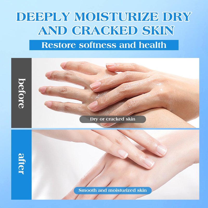 URQT 42% Urea Cream for Dry & Cracked Skin - Foot & Hand Cream with 2% Salicylic Acid, 5% Vitamin E, Tea Tree Oil, Aloe Vera, Shea Butter - Moisturizer & Skin Repair Cream for Feet Maximum Strength - Image 5