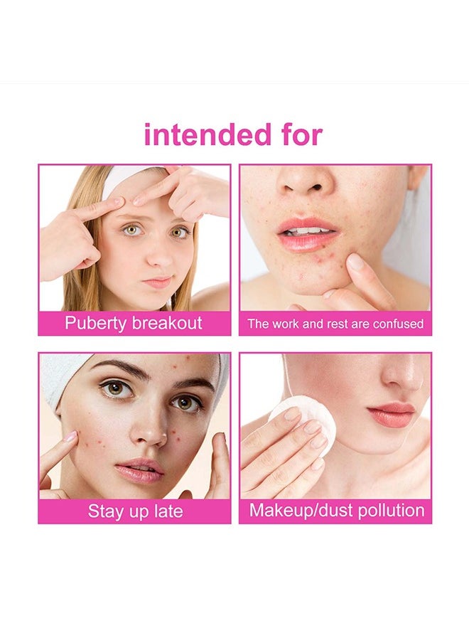 EELHOE 160Pcs Pimple Patches for Face,Hydrocolloid Acne Patches for Covering Zits and Blemishes, Cute Spot Stickers for Skin Care  - Image 5