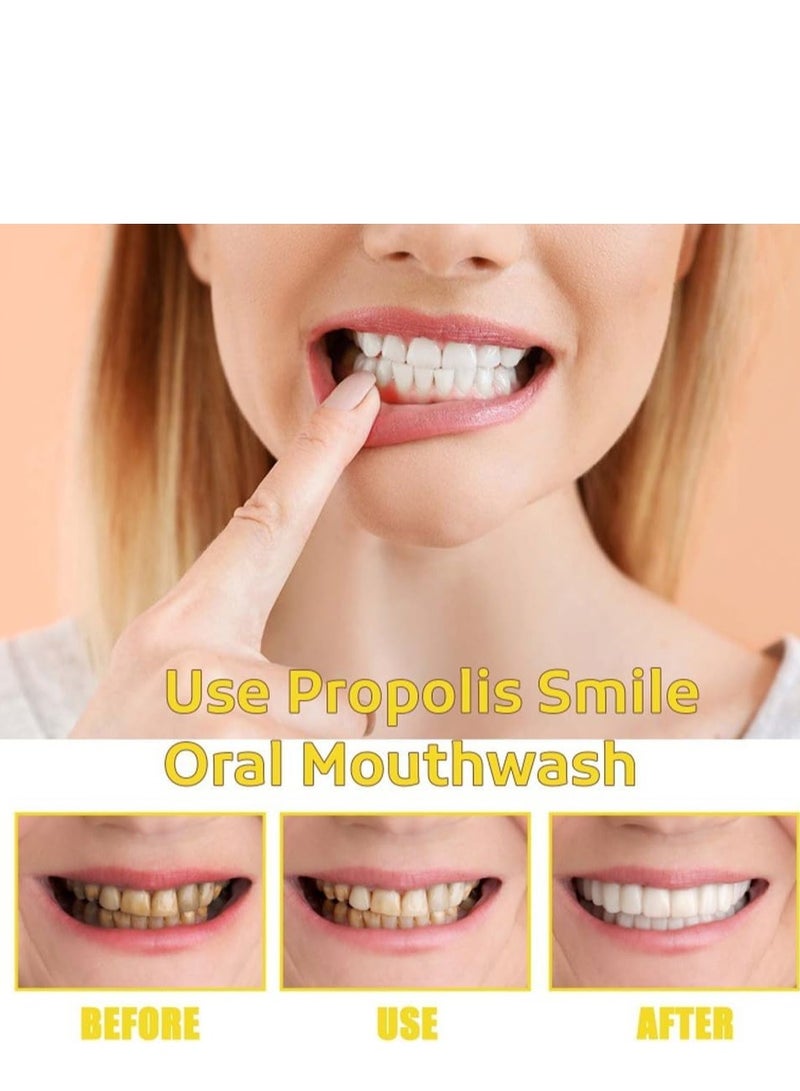 أورالحوي بخاخ غسول الفم عن طريق الفم Propolis ، بخاخ تنظيف الأسنان واللسان الطبيعي لرائحة الفم المنعشة ، التنظيف العميق والعناية بالفم ، مناسب لجميع الأعمار (60 مل) - Image 2