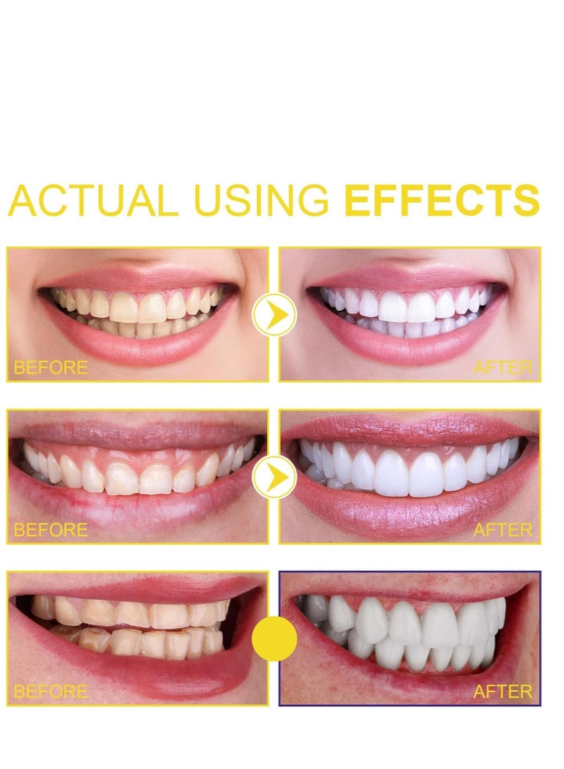 أورالحوي بخاخ غسول الفم عن طريق الفم Propolis ، بخاخ تنظيف الأسنان واللسان الطبيعي لرائحة الفم المنعشة ، التنظيف العميق والعناية بالفم ، مناسب لجميع الأعمار (60 مل) - Image 4