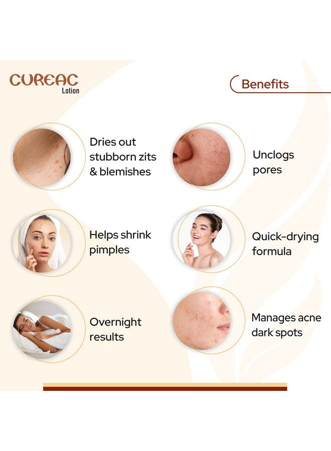 Salve Acne Drying Lotion For Overnight Results For Teens & Adults Fights Pimpleszits & Blemishes70 Ml (Pack Of 1) - Image 3