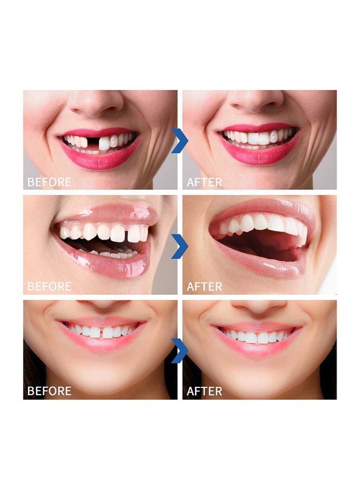 Silicone Silcone Denture Set-Teeth Veneers Whitening Dentures Imitation Braces Temporary False Teeth Cover Perfect Smile Comfortable Fit Denture Kit，Temporary Teeth Filling Repair Kit - Image 4