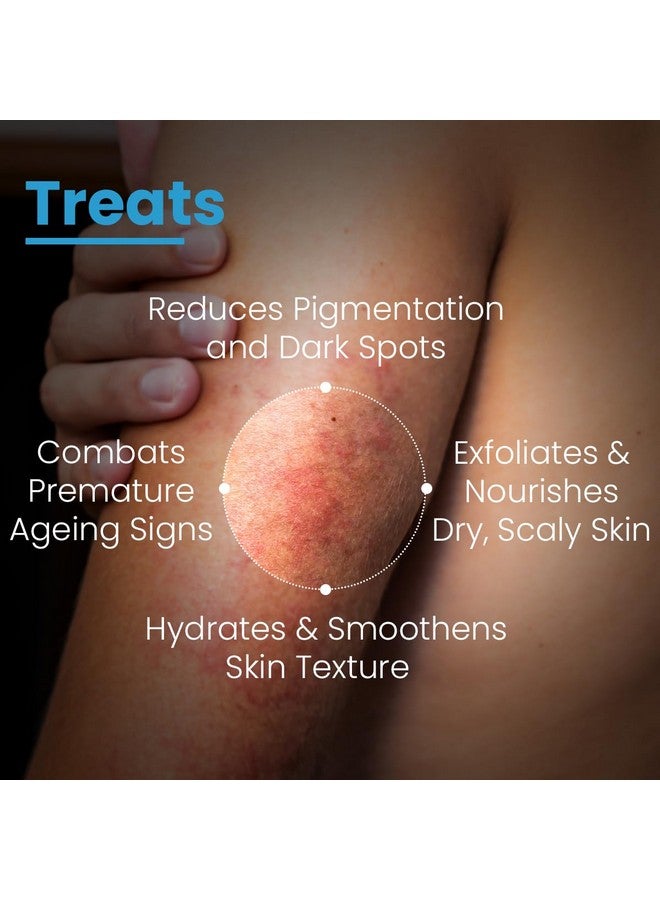 FIXDERMA لوشن FCL Aha 10 يرطب البشرة ويخفف الجفاف لتفتيح وتبييض البشرة 100 مل - Image 5