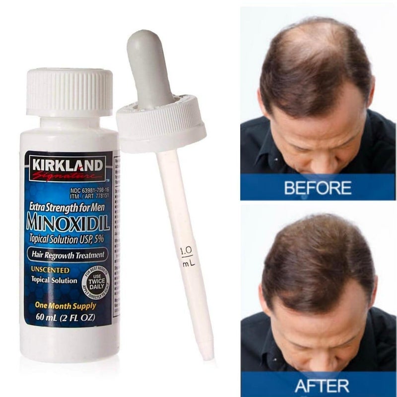 Kirkland Signature Minoxidil 5% Topical Solution for Men - 6 Month Supply (6 x 2 Fl Oz), Hair Regrowth Treatment with Dropper - Image 3