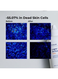 P.CALM Light Active Toner 6.7 Fl.Oz Vegan Hyperpigmentation Dark Spot Correction Facial Toner For Sensitive Skin Korean Skincare  - Image 5