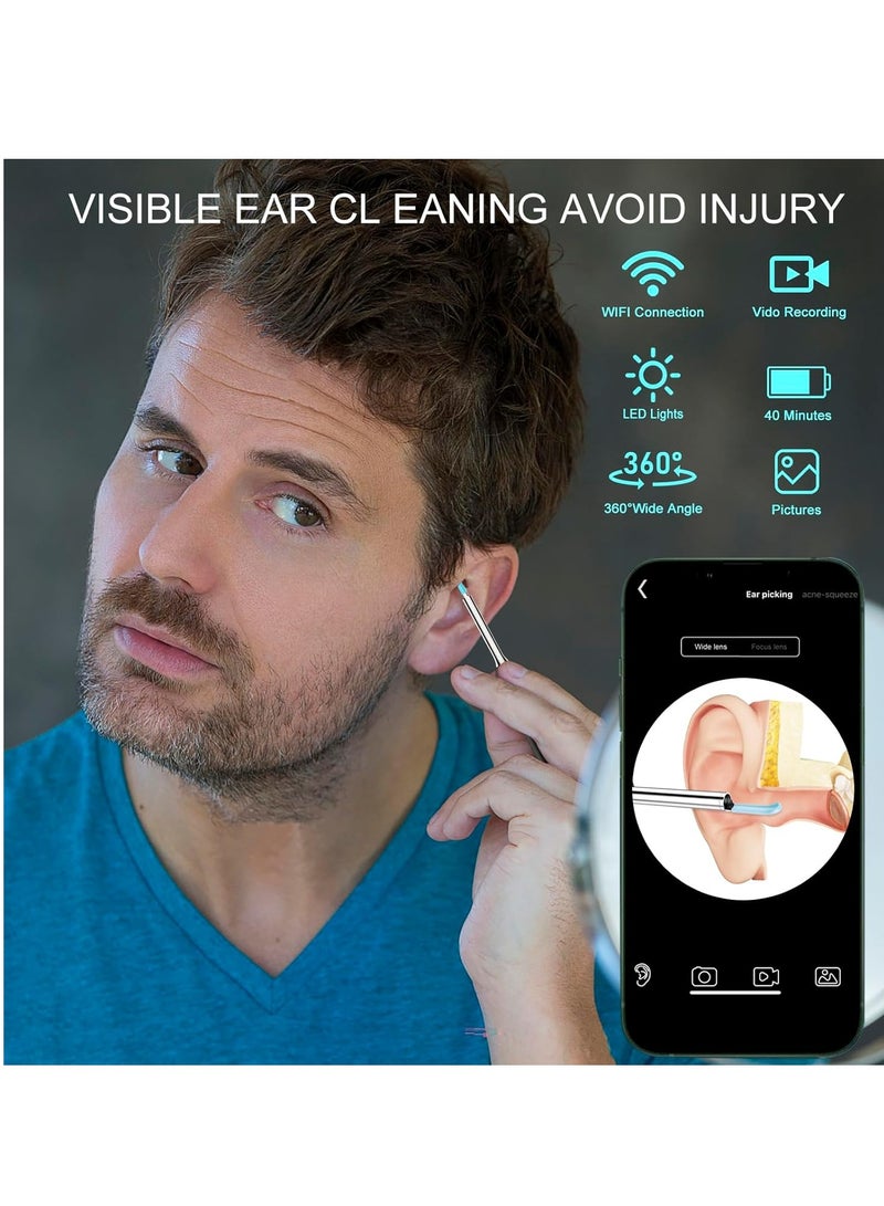 Generic Ear Wax Removal Kit, Wireless Ear Wax Remover, Visible Ear Wax Remover with Camera, Otoscope with Light, Ear Cleaner with 8 Ear Pickers + 6 Ear Scoops, for iOS, Android Phones  - Image 3
