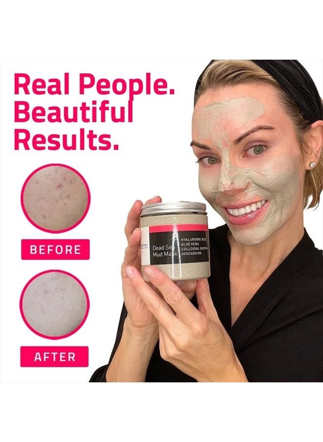 Yeouth - Dead Sea Mud Masks for face with Hyaluronic Acid, Clay Mud for Pore, Wrinkles, Acne & Dark Spots, Anti Aging Masks for Women & Mens Face Mask Skin Care - Image 1