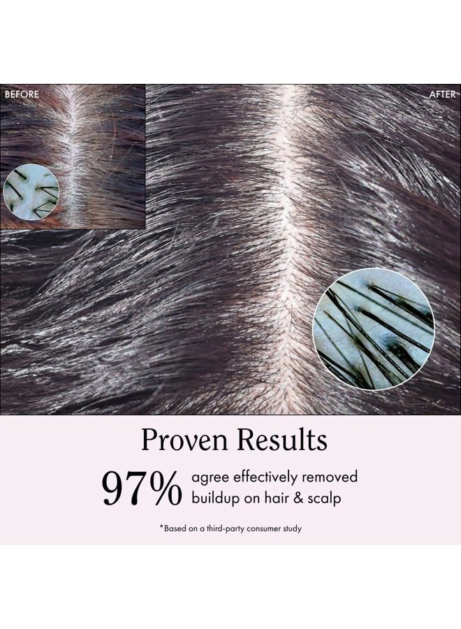 Rizos Curls خل التفاح لشطف فروة الرأس والشعر، ينظف لإزالة تراكم المنتجات، يوازن الزيوت، ينشط الشعر وفروة الرأس، يعزز النعومة واللمعان، 10 أونصات - Image 4