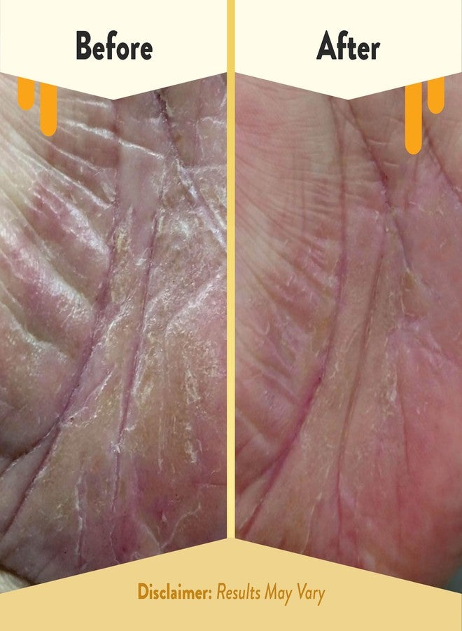 ECZEMA HONEY Brown Sugar Face & Body Scrub - Bath Scrub for Dry Skin - Natural & Gentle Face Scrub Soothes Eczema - Body Care Products for Women & Men - Sensitive Skin Exfoliating Body Scrub (6 Oz) - Image 4