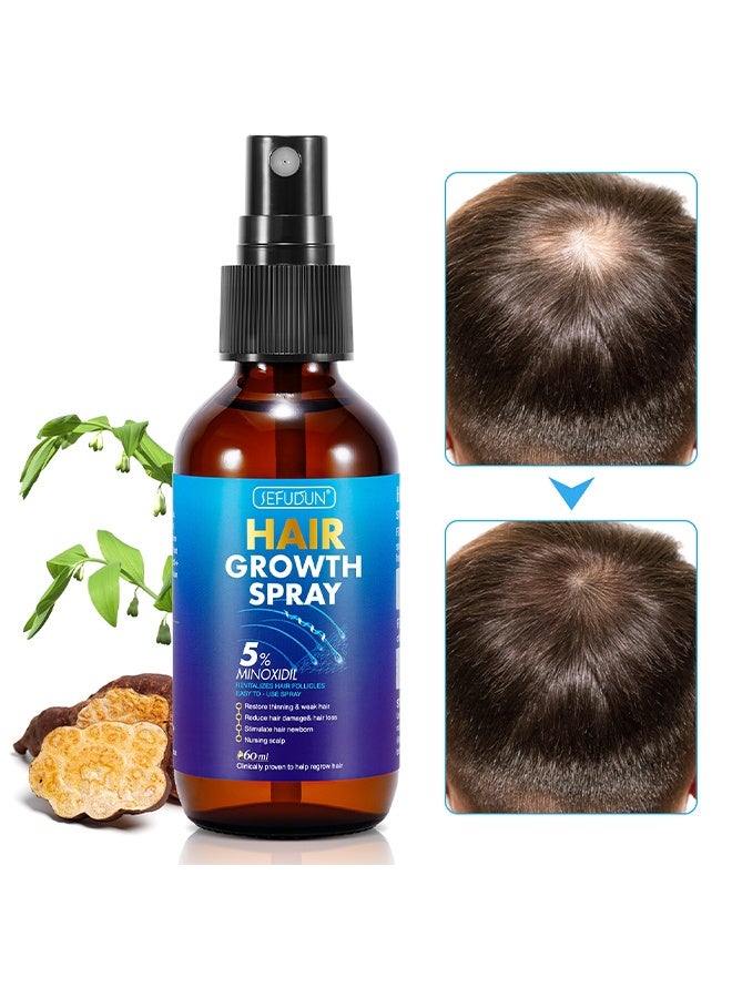 Sefudun 5% Minoxidil Hair Growth Spray, for Longer Thicker Fuller Hair Professional Treatment for Hair Loss and Hair Regrowth Treatment Serum Minoxidil for Men and Women 60ml - Image 1
