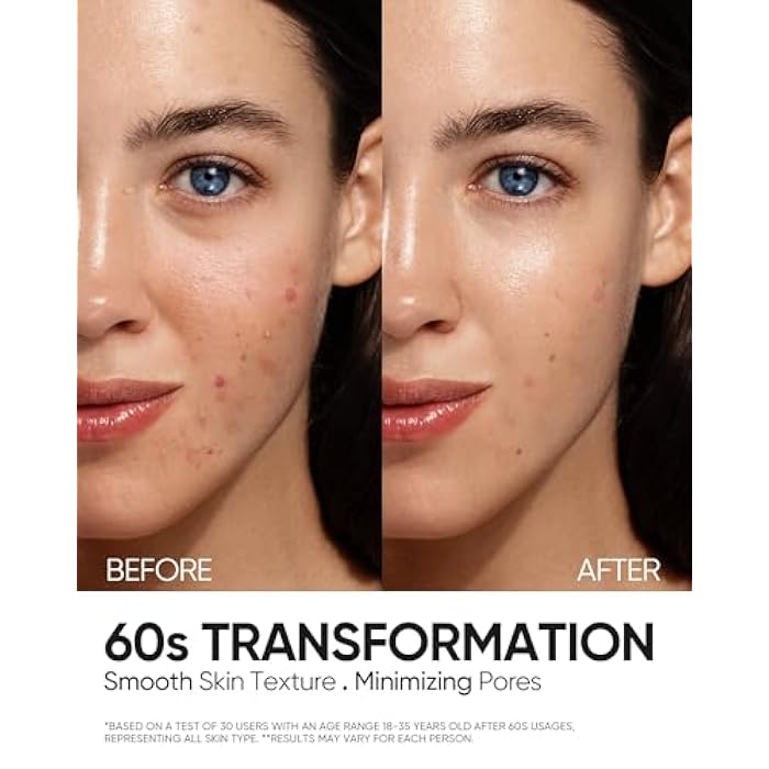 SKINTIFIC 12% AHA BHA PHA LHA Peeling Solution, Glycolic Acid Acne Treatment for Face, Exfoliating Peeling Serum for Dull, Rough, Oily Skin with Clogged Pores & Dead Cells - Image 5