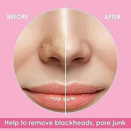Generic 5 Pack Blackhead Pore Strips Deep Cleansing Charcoal Nose Strips for Instant Blackhead Removal Pore Minimizer Natural Charcoal Facial Pore Cleaner  - Image 3