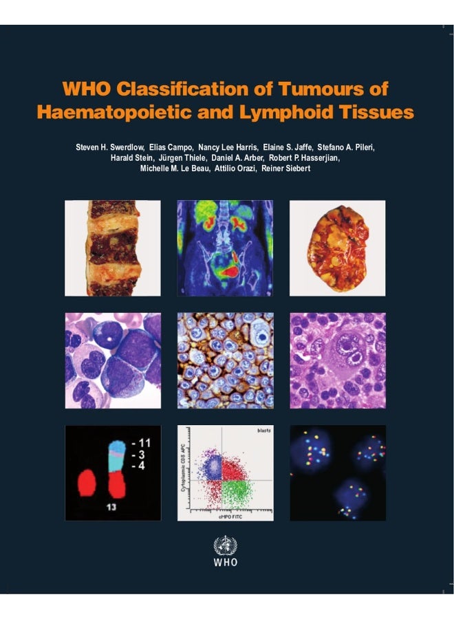 WHO classification of tumours of haematopoietic and lymphoid tissues: Vol. 2