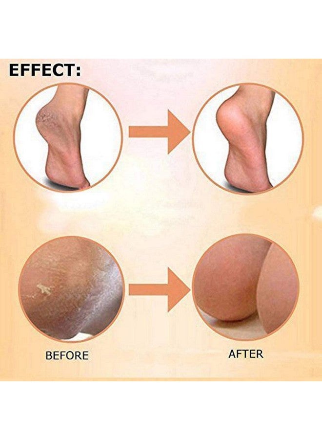 GTC® Silicon Foot Protector/Moisturizing Silicone Gel Heel Socks Cracked Foot Skin Care Protector (1 Pair) 712-103 - Image 5