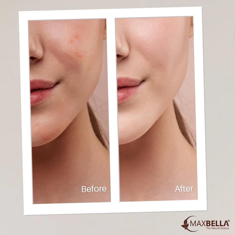 MaxBella Instant Makeup  Spot Coverage Cream  Primer  Highlighter  Moisturizer  Niacinamide and Non comedogenic  Intense Hydration  Flawless Radiant Dewy Skin  Illuminating  Glowing Makeup Base 45g - Image 5