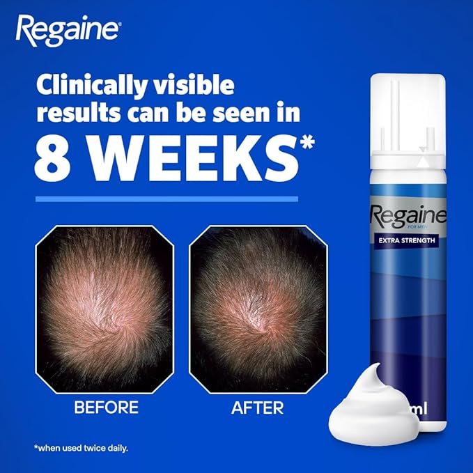 Regaine رغوة ريجين القوية لفروة الرأس 3x 73 مل لعلاج إعادة النمو للرجال مع 5 مينوكسيديل لفقدان الشعر لدى الرجال - Image 3
