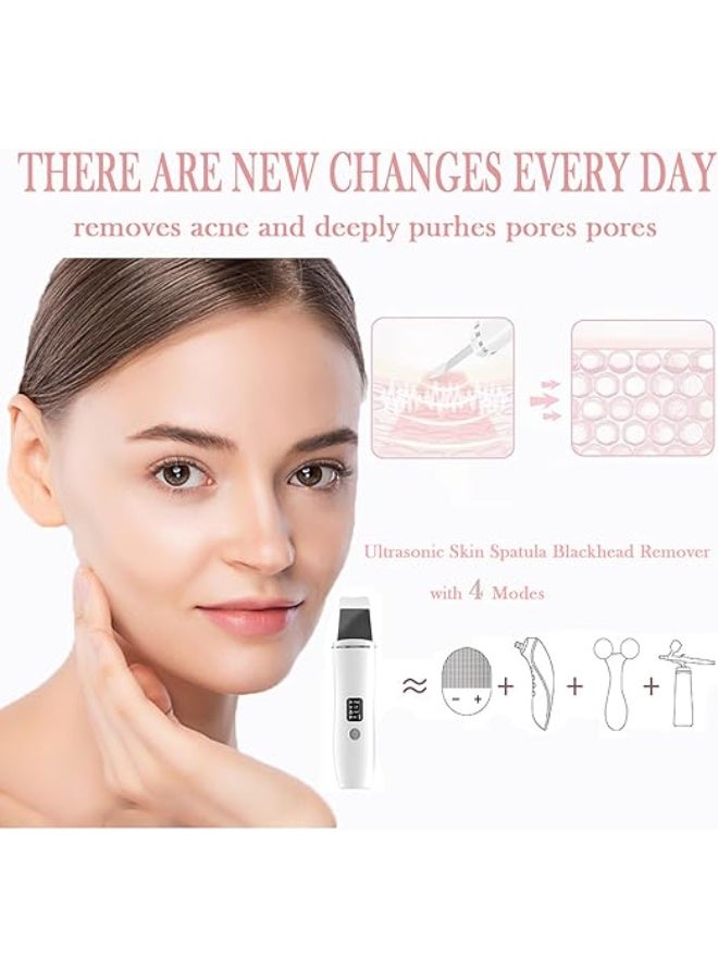 جهاز تقشير وتنظيف البشرة بالموجات فوق الصوتية، سباتولا لإزالة الرؤوس السوداء وتنظيف المسام بعمق، قابل للشحن مع 4 أوضاع مختلفة - Image 3