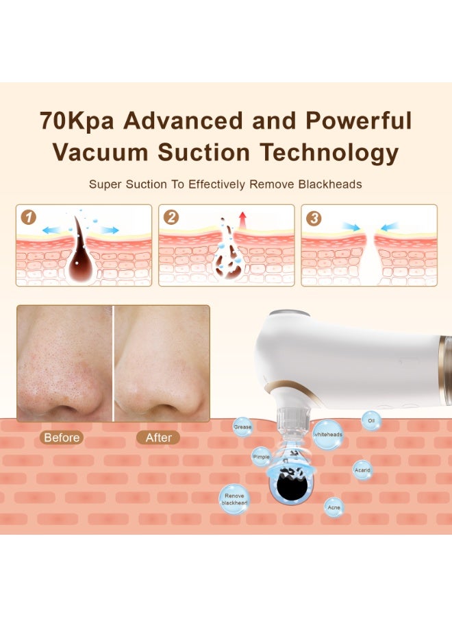 iMESA Electric Blackhead Remover Pore Vacuum With Cold and Hot Compress, Hydrafacial Machine, Pore Vacuum, Face Suction Pore Cleanser, 4 Removable Suction Heads, 3 Suction Levels, USB Rechargeable ,for Women & Men at Home and Travel - Image 3