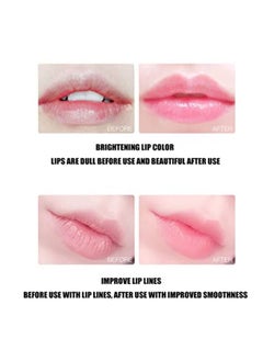 Generic 6Pcs Moisturizing Lip Mask Set For Dry And Cracked Lips  - Image 5