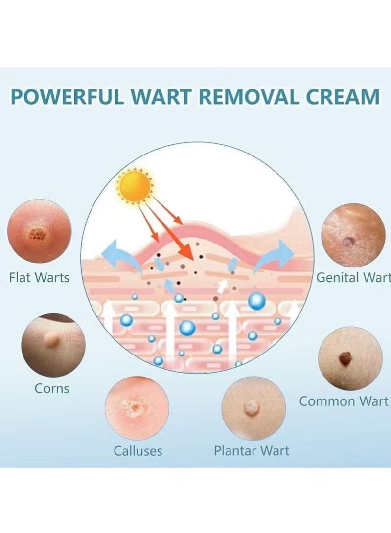 SOUTH MOON Wart Ointment With Salicylic Acid, Fast Acting Wart Remover For Common Warts, Plantar Warts, Corns, And Other Skin Growths, Safe And Effective Ointment (2pcs) - Image 3