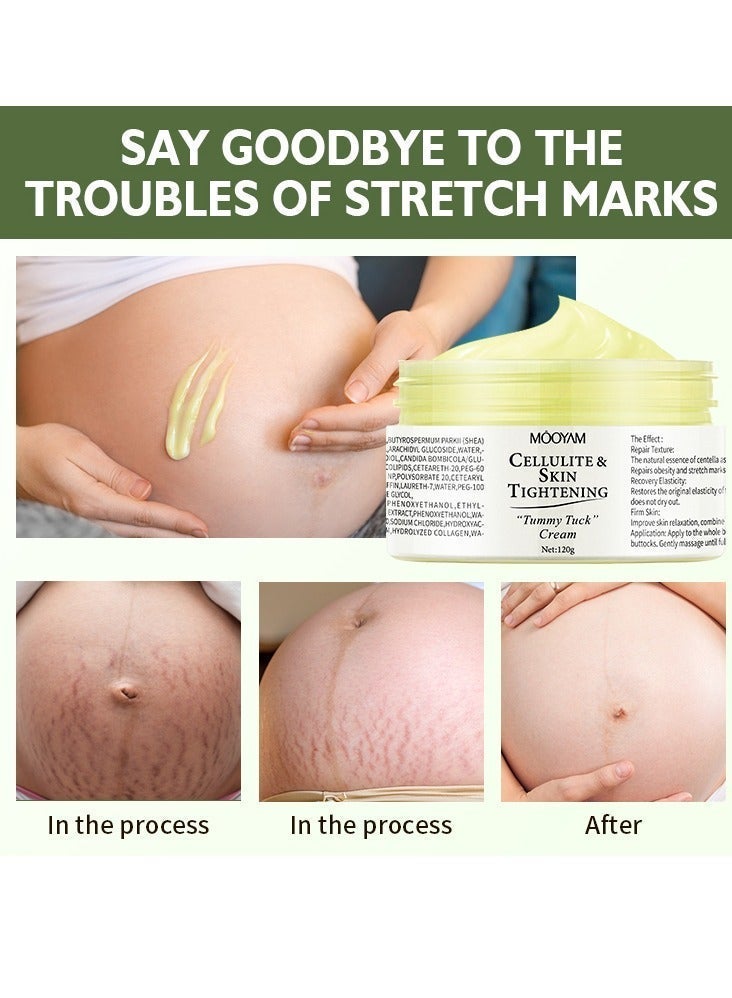 MOOYAM 120g Cellulite and Skin Tightening Cream Firming Gel, Firms and Smooths Abdomen, Moisturizing Body Cream for Body Stretch Mark Reduction - Image 2