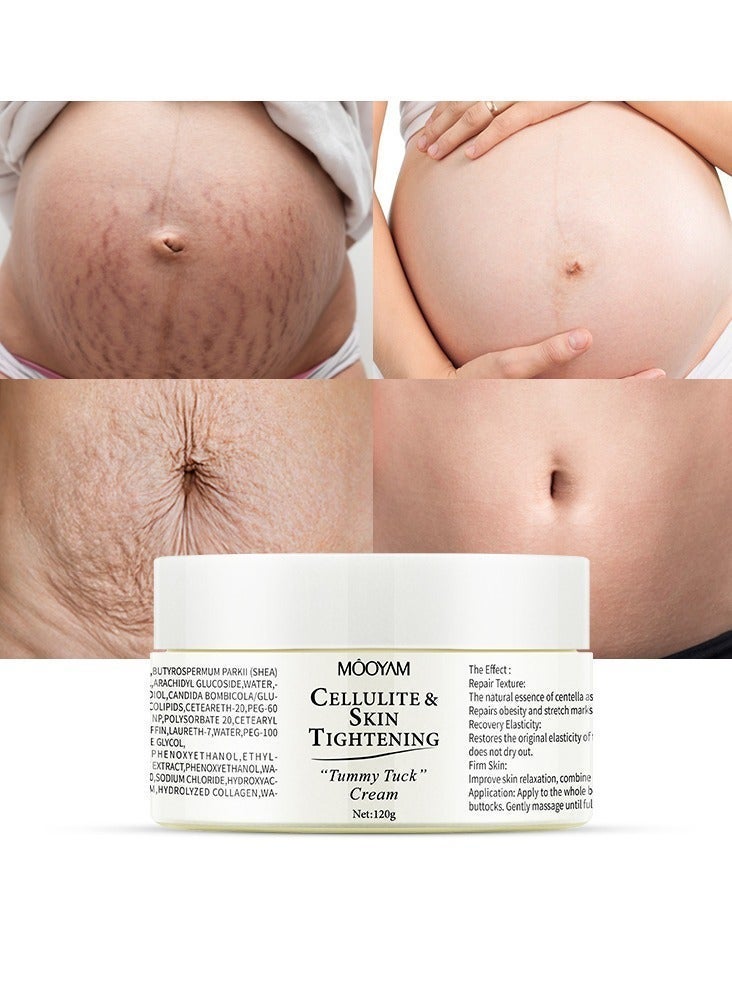 MOOYAM 120g Cellulite and Skin Tightening Cream Firming Gel, Firms and Smooths Abdomen, Moisturizing Body Cream for Body Stretch Mark Reduction - Image 1