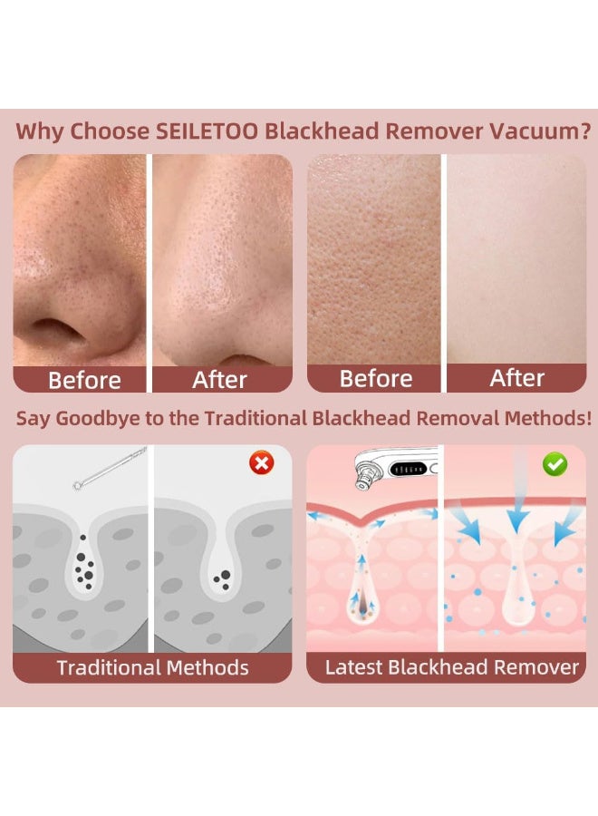 5 سرعة ​​ Blackhead Remover الفراغ ، نوع C القابل لإعادة الشحن Blackhead Extractor مع 4 رؤوس قابلة للإزالة ، Black Head Extractor Tool للنساء والرجال ، إزالة الرؤوس البيضاء للوجه والأنف - Image 2
