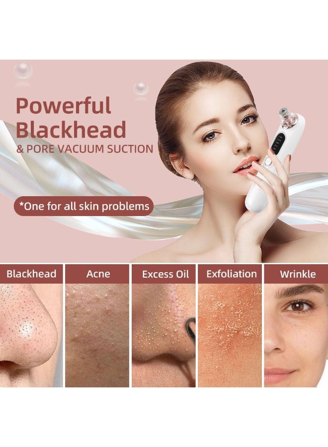 5 سرعة ​​ Blackhead Remover الفراغ ، نوع C القابل لإعادة الشحن Blackhead Extractor مع 4 رؤوس قابلة للإزالة ، Black Head Extractor Tool للنساء والرجال ، إزالة الرؤوس البيضاء للوجه والأنف - Image 3