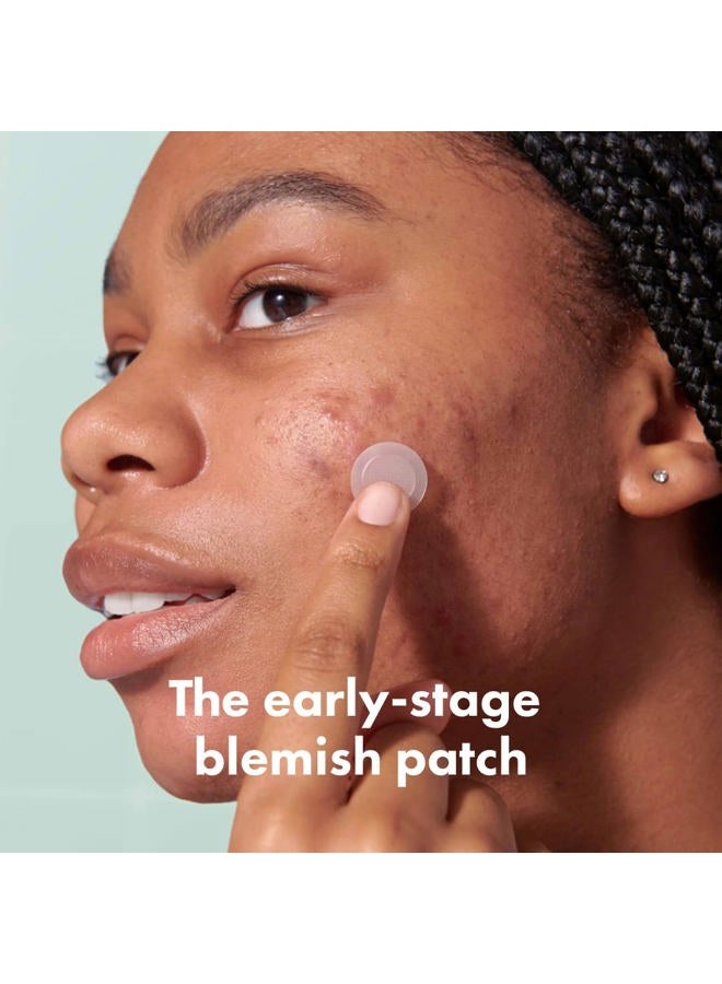 Mighty Patch ميكروبوينت™ للبقع من هيرو كوزمتيكس - لاصقة علاج حب الشباب الهيدروكوليدية للبثور المبكرة والبثور المخفية، 395 ميكروبوينت (8 لاصقات) - Image 2