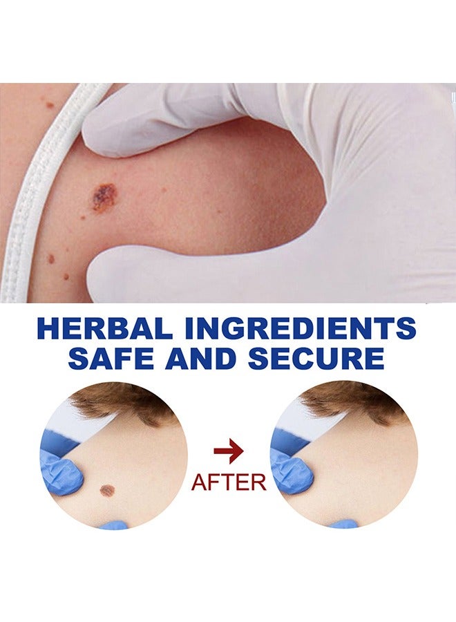 إيلهو Wart Removal Ointment Natural Herbal，Wart Remover Treatment Skin Repair Cream Against Moles Warts Use On Any Parts Of Body 20g - Image 4