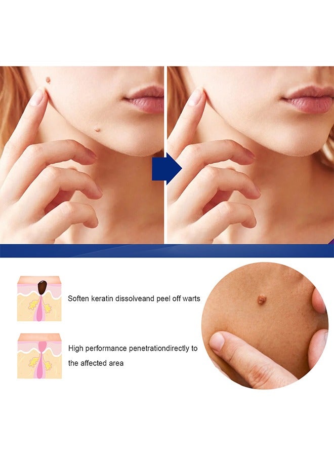 إيلهو Wart Removal Ointment Natural Herbal，Wart Remover Treatment Skin Repair Cream Against Moles Warts Use On Any Parts Of Body 20g - Image 5