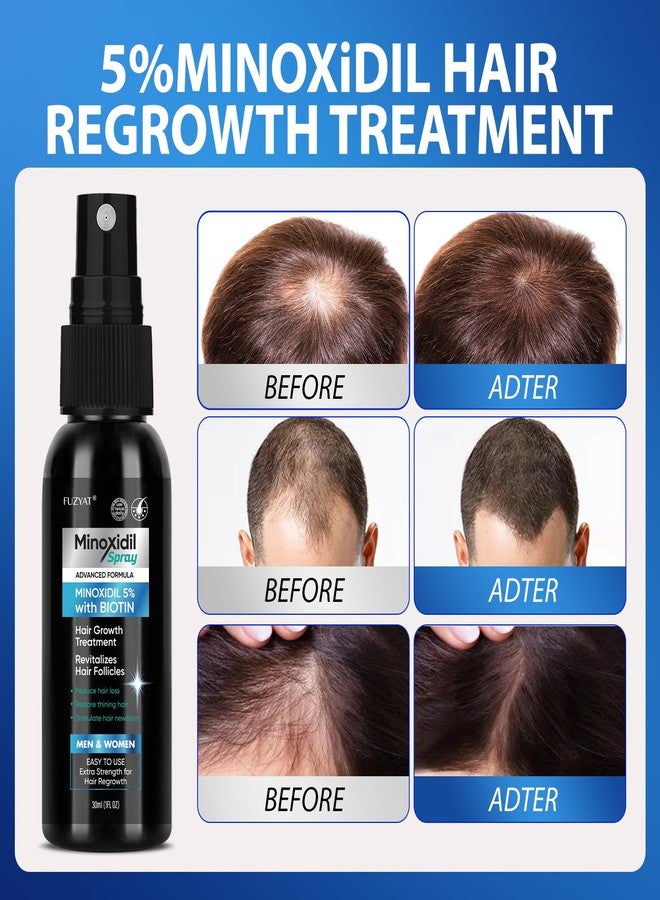 FUZYAT 5% Minoxidil for Men Hair Loss Treatment, Minoxidil for Women Hair Growth Spray, For Men & Women, Supports Thinning Hair, With Biotin, Easy Daily Application (60ml) - Image 3