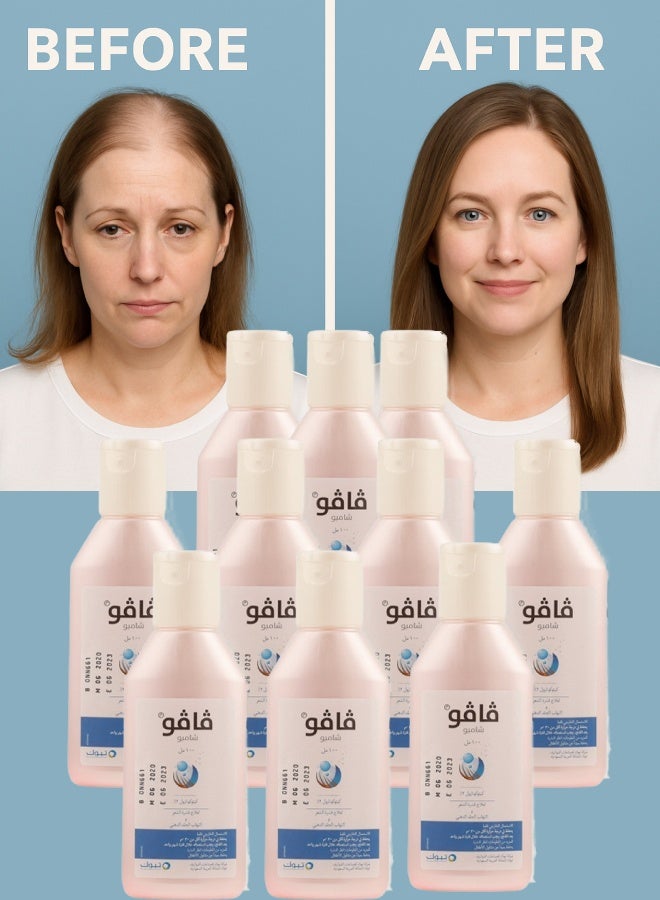 فافو 10 قطع فافو 2% شامبو 100مل - Image 1