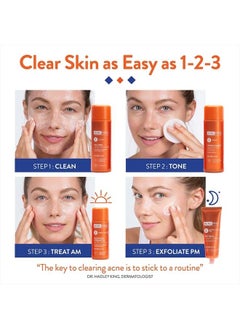 AcneFree Severe Acne 24 Hour Clearing System for Stubborn Acne, 4 Step Routine Kit  - Image 4