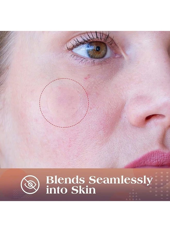 AUSLKA Blemishes Patches -175 Patches - Hydrocolloid Spot Dots - Blemishes Patch - Pimple Stickers, for Face Absorbing Cover Patch - Image 2