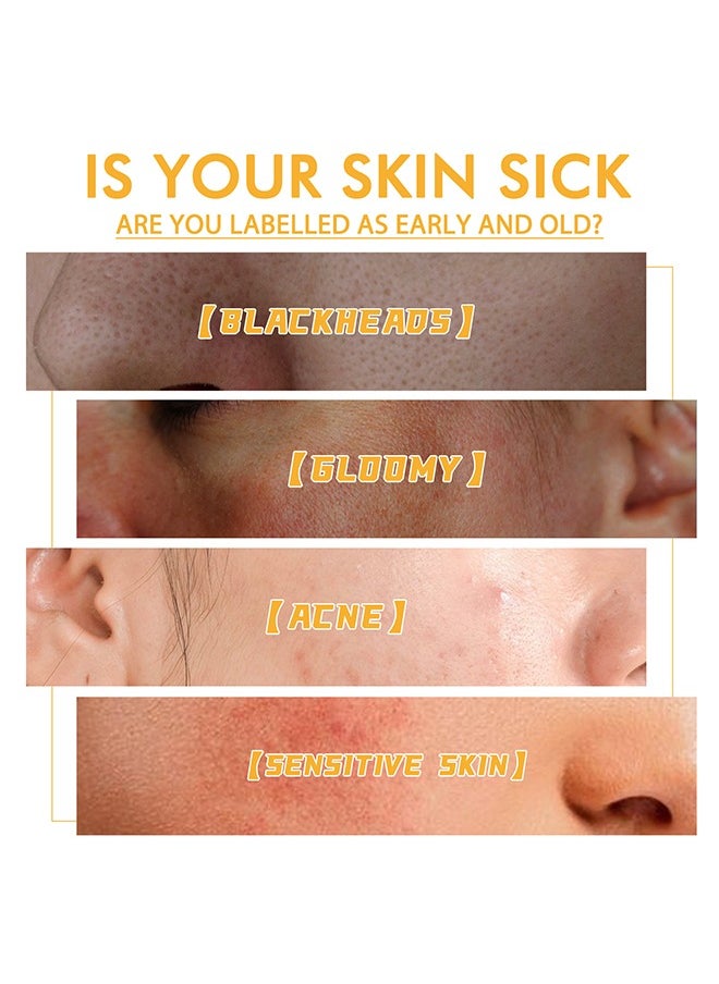 EELHOE - Honey Tearing Mask, Honey Mask, Oil Control Blackhead Remover Honey Tearing Peel Mask Off Dead Skin Clean Pores Peel Mask Dead Skin - Image 1