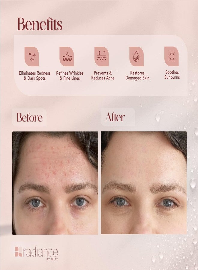 Radiance By Mist سيروم موكوس الحلزون المتألق مع قوة خلاصة موكوس الحلزون 96%، العناية بالبشرة الكورية مع حمض الهيالورونيك المرطب، سيروم كوري، 3.38 أونصة سائلة، 100 مل - Image 3