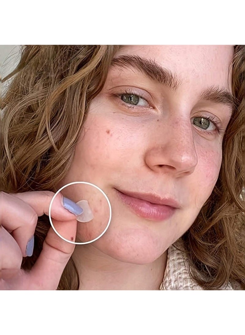 Shein 360 Hydrocolloid Acne Patches – Oil-Absorbing, Fast-Healing Pimple Stickers for Acne-Prone Skin - Image 2