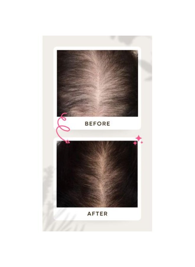 مُعزز الجذور - مقوي الجذور ومحفز النمو - 100 مل (عبوة مزدوجة) - Image 2